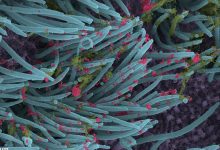 Coronavirus