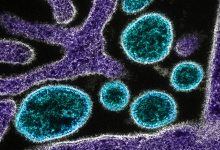 Virus