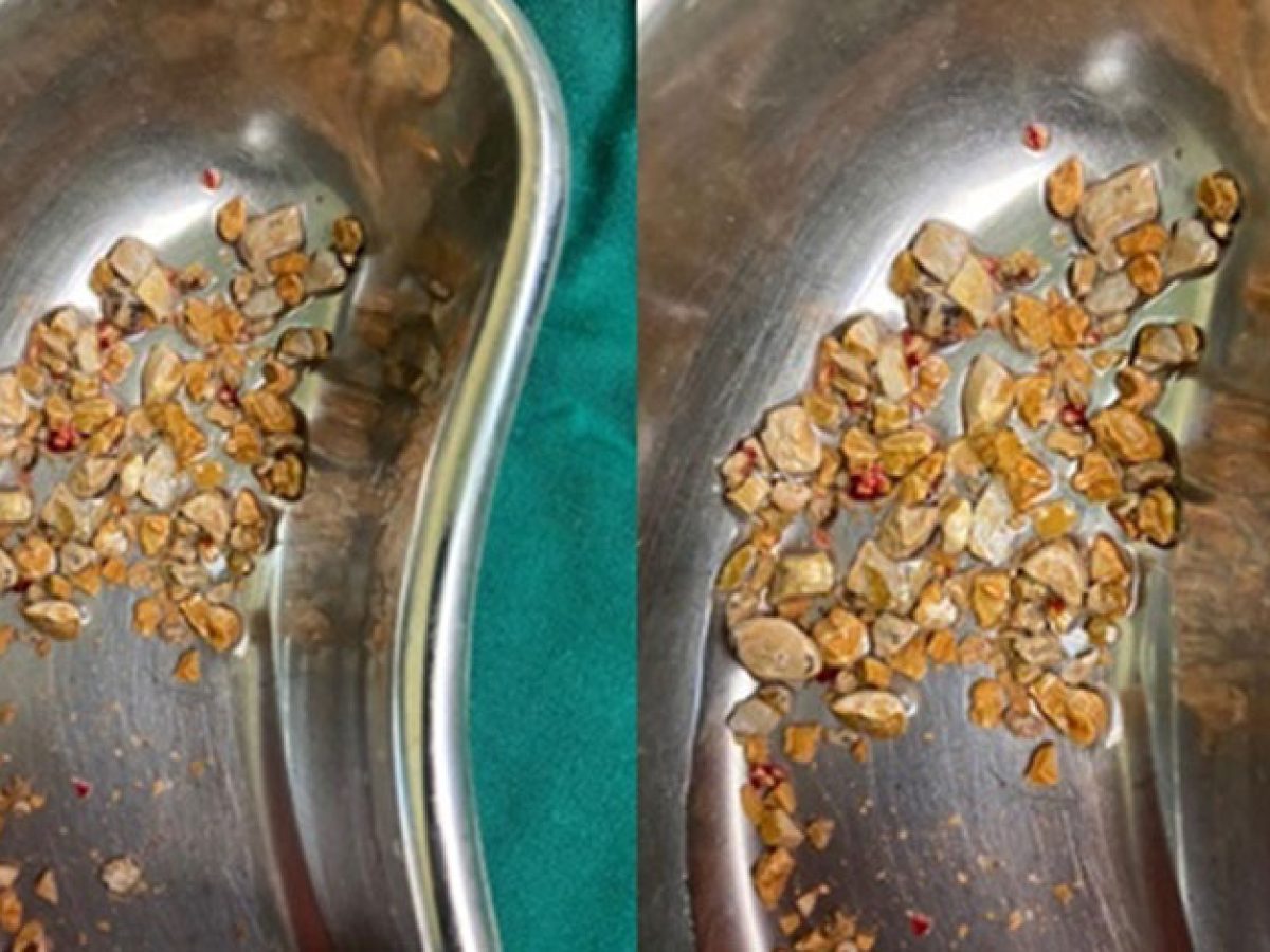 Oq külotli dumbali dumbalar