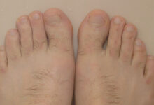 Feet