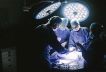 Operation