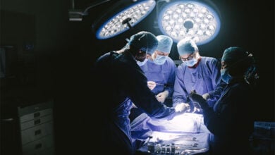 Operation