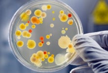 Bacteria