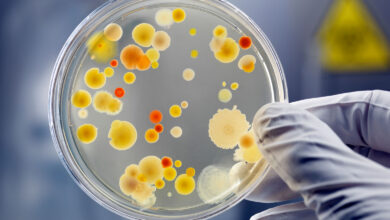 Bacteria