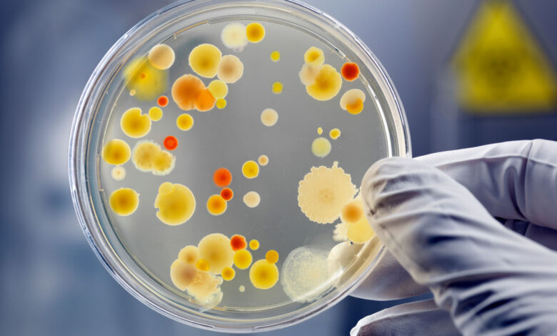 Bacteria