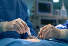 Operation