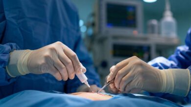 Operation