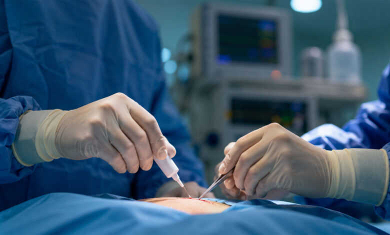 Operation