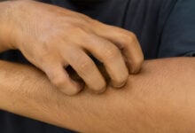 Hands
