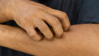 Hands