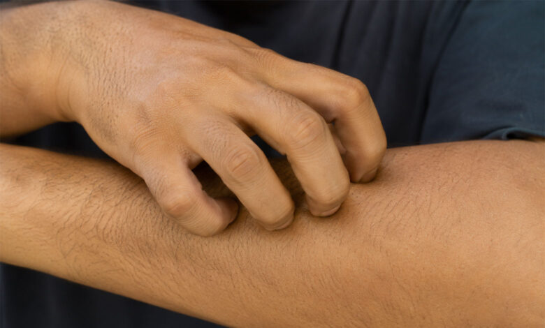 Hands